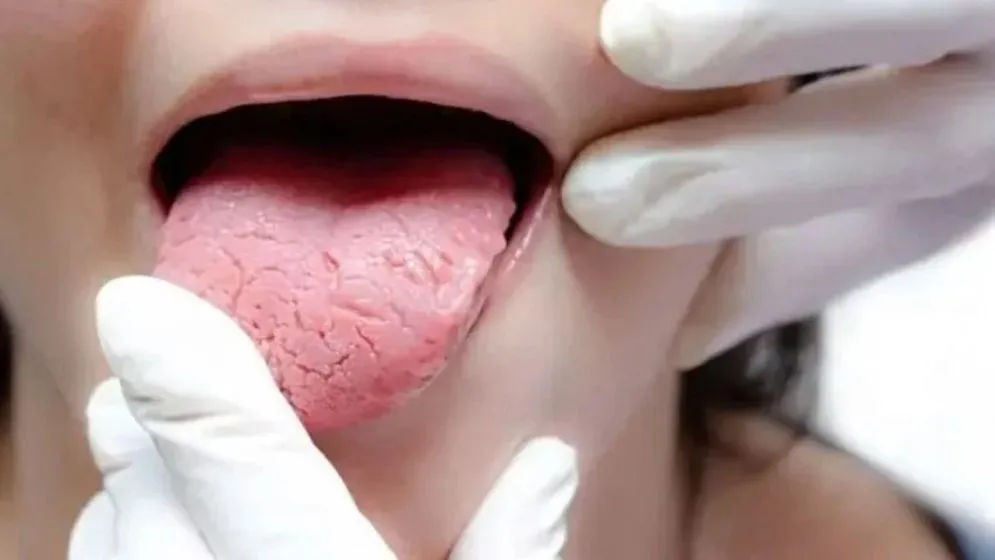 মুখের ব্যাকটেরিয়াই বাড়াতে পারে হৃদরোগের ঝুঁকি