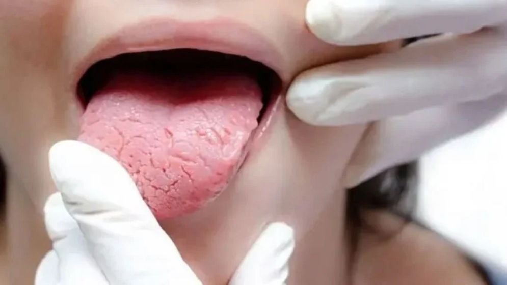 oral-germs-68b7ea12e4f04