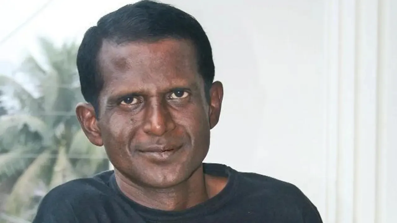 দুই সপ্তাহ ধরে হাসপাতালে চিকিৎসাধীন অভিনেতা হাসান মাসুদ